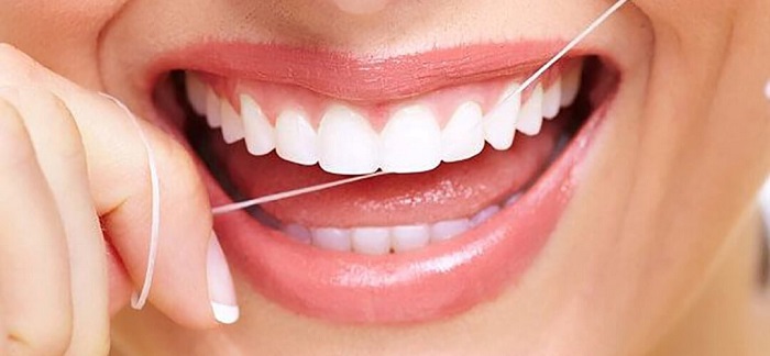 Chăm sóc răng miệng sau khi niềng răng đúng cách
